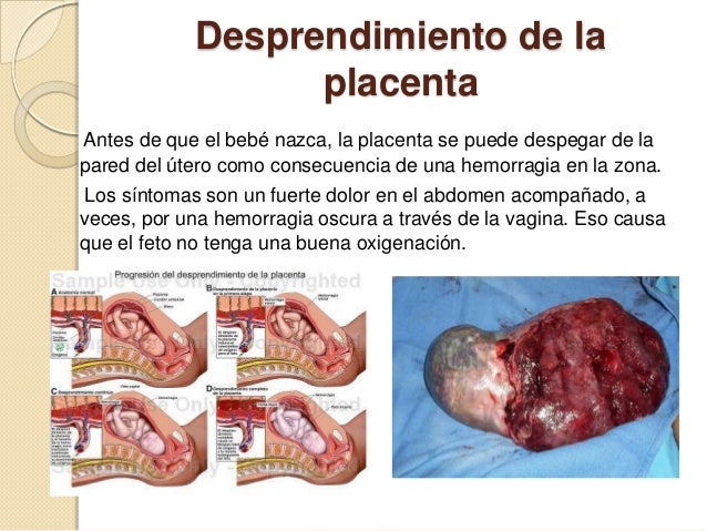 El pequeño pecho grande los máses y el menos