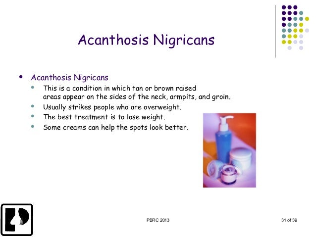 Acanthosis nigricans: MedlinePlus Medical Encyclopedia