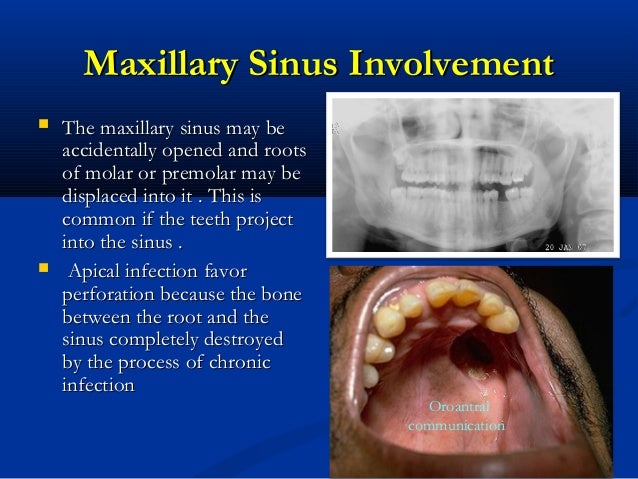swollen sinuses humidity