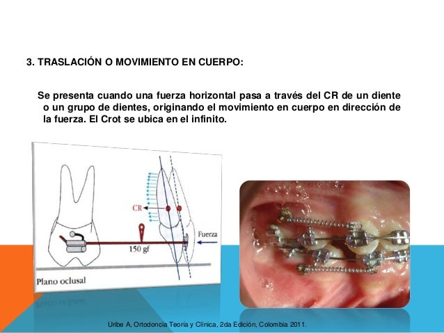 Conceptos basicos de biomecanica en ortodoncia