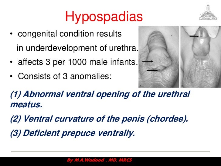 Congenital anomalies ppt