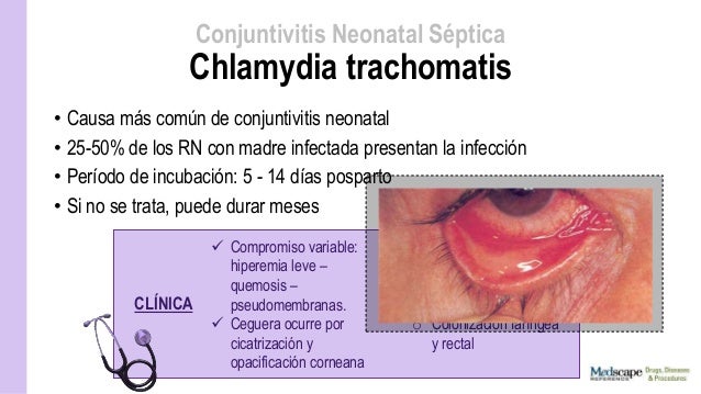 Conjuntivitis neonatal
