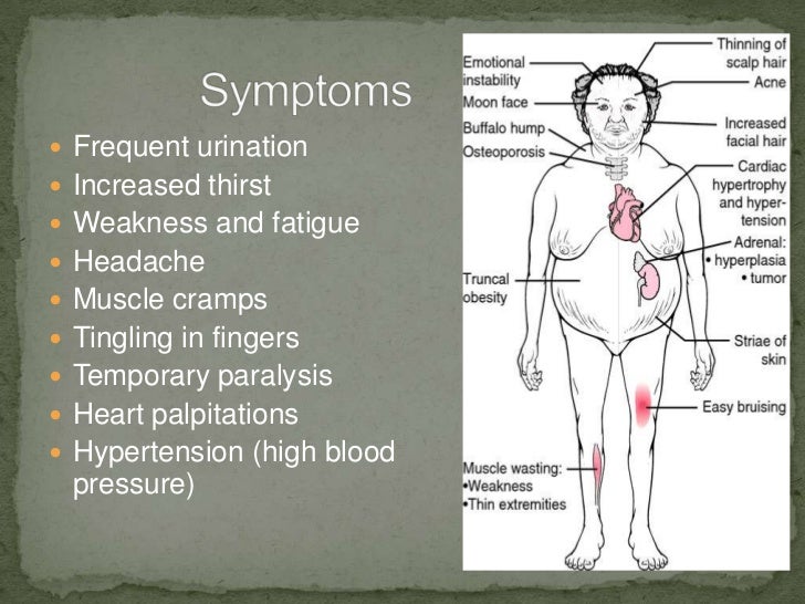 Conn’s syndrome group project