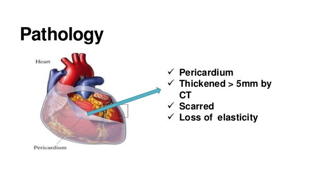 What's a thrombotic stroke hemorrhagic stroke vs embolic stroke