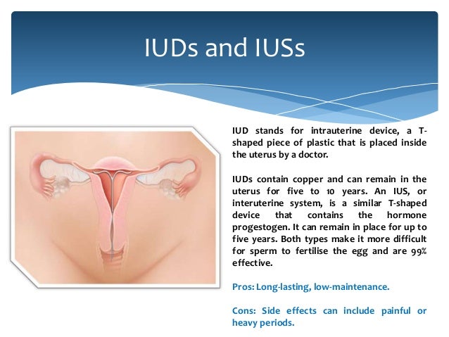 Pros And Cons Of Intrauterine Devices
