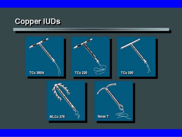 pictures of iud types kidskunst info iud types