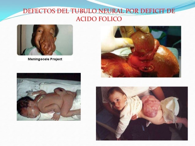El hombre con un pequeño miembro como ser