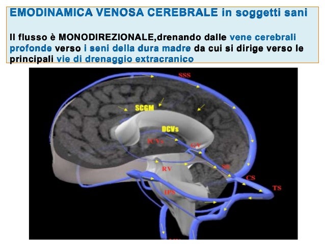 Distruzione di vene varicose