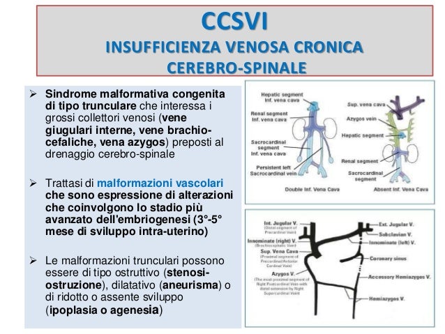 Il phlebologist negli ospedali statali