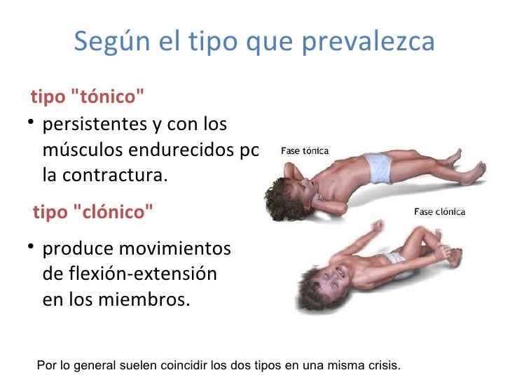 Convulsiones En La Infancia Y Sindromes Neurocutaneos Convulsiones En La Infancia Y Sindromes Neurocutaneos