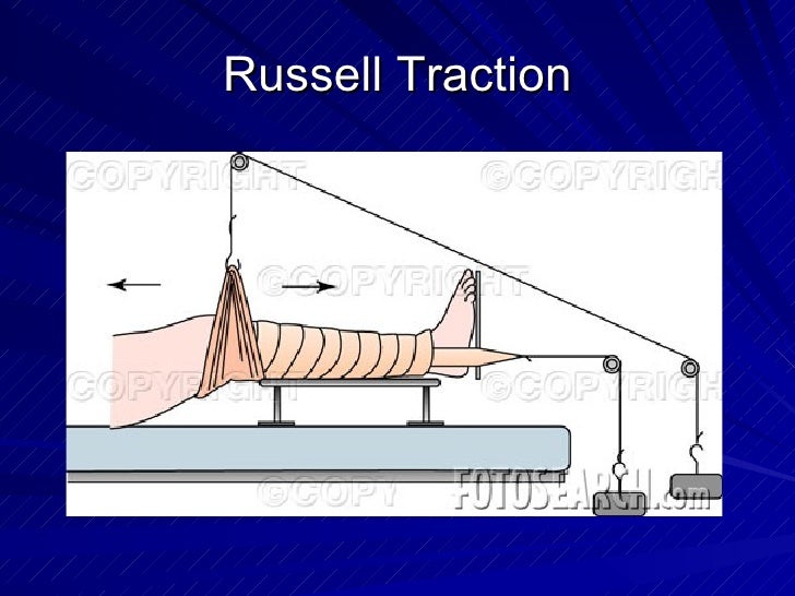Musculoskeletal System