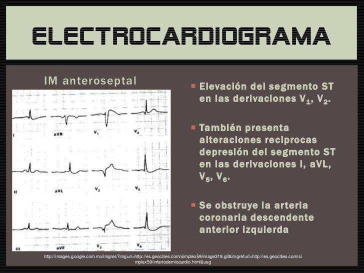 Atlas De Anatomia Humana Yokochi Portugues