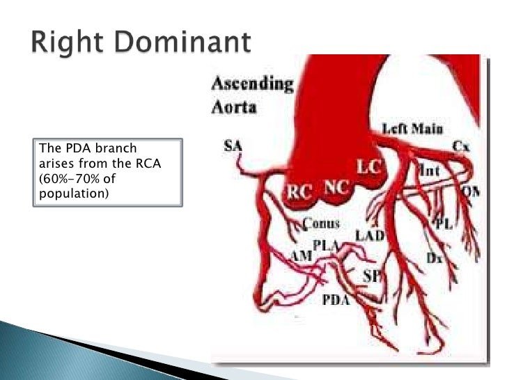 left dominant vs right dominant heart
