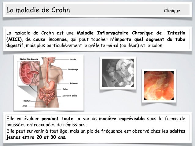 Analyse économique des traitements dans les Maladies Analyse économique des traitements dans les Maladies