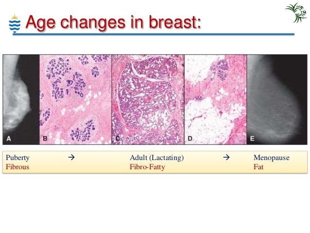 pagets disease of the breast pictures 56322 pagets disease of the breast pictures 56321