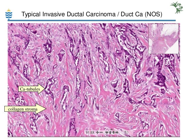 robbins pathology lecture notes pdf
