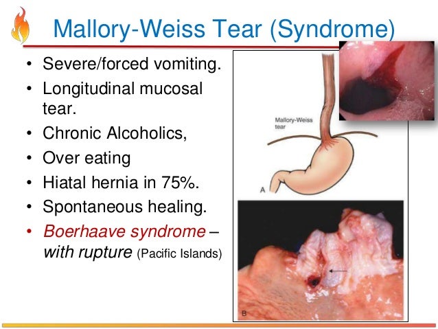 Stroke recovery elderly stroke rehabilitation inpatient