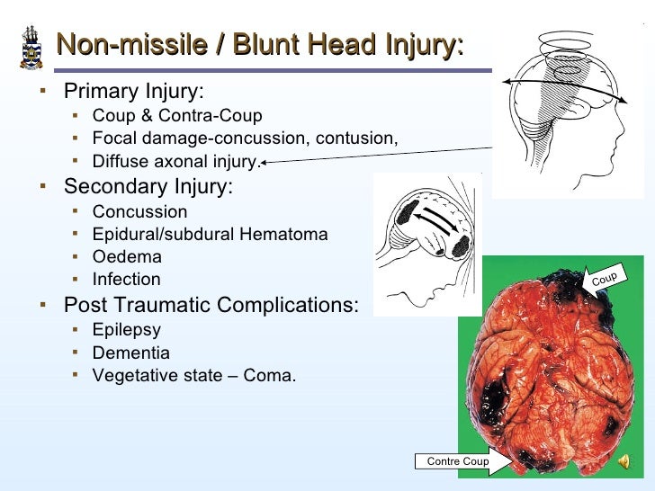 Pathology of Head Injury