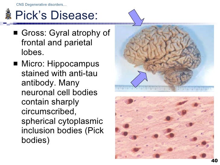 Pathology of CNS degenerations