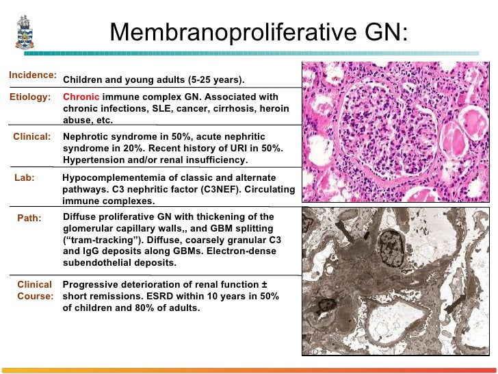 Pathology of Glomerulonephritis