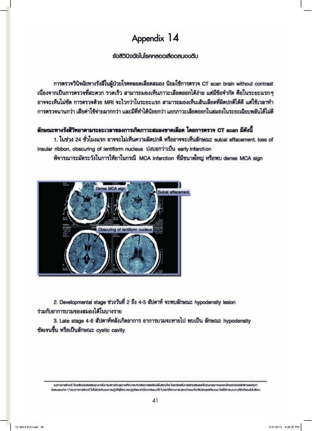 medicine after stroke