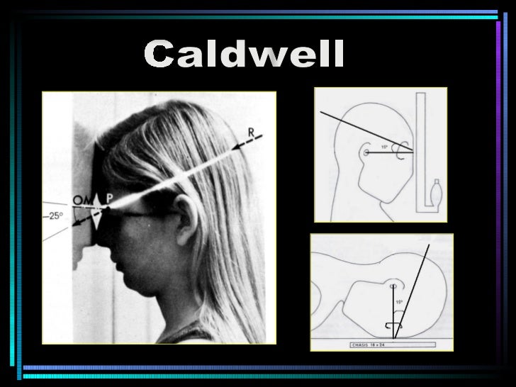 RADIO ANATOMIA CRANEO
