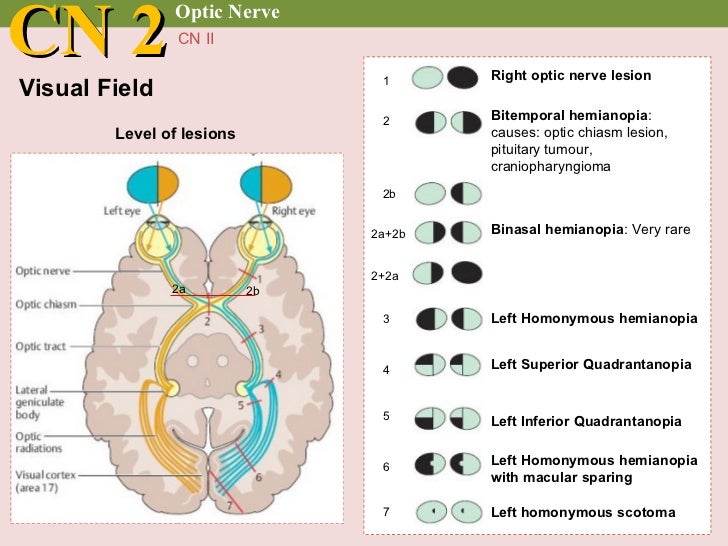 Cranial nerve examination