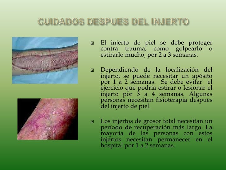 Cristhy diapositivas injertosde piel Cristhy diapositivas injertosde piel