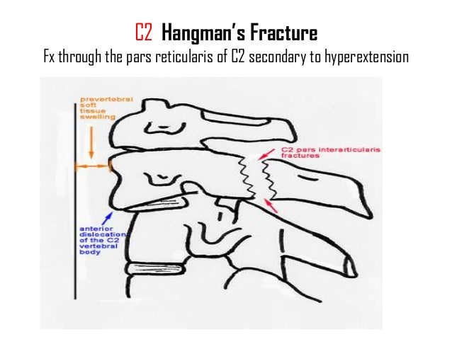 most cancers de cervix uterino