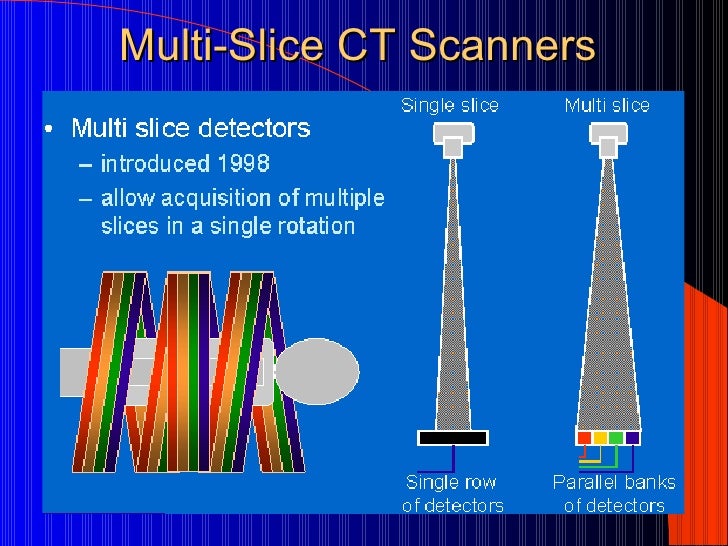 Single Slice Ct Vs Multislice Ct