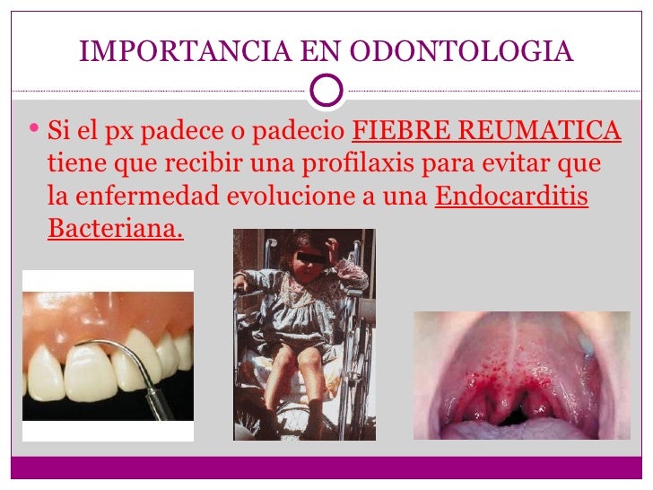 Cuidado del paciente diabetico y con fiebre reumatica Cuidado del paciente diabetico y con fiebre reumatica