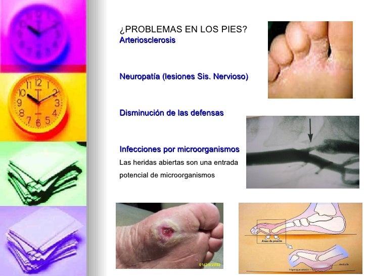 El ungüento para el tratamiento contra el hongo sobre la cabeza del miembro