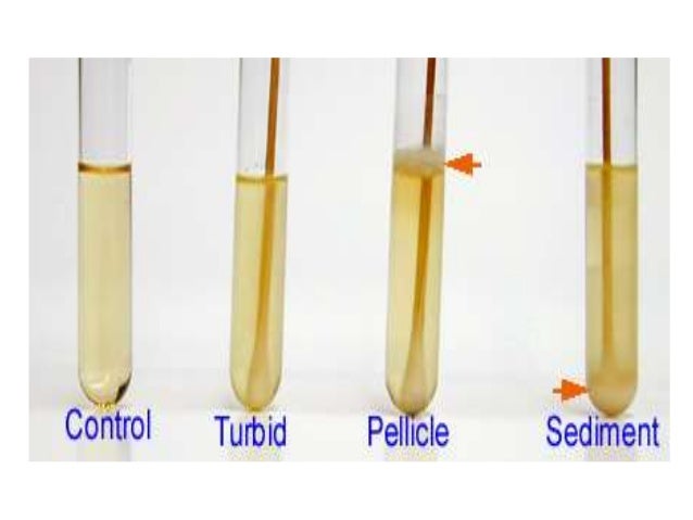 Growth Pattern En Francais | culture characteristic of bacteria Growth Pattern En Francais | culture characteristic of bacteria