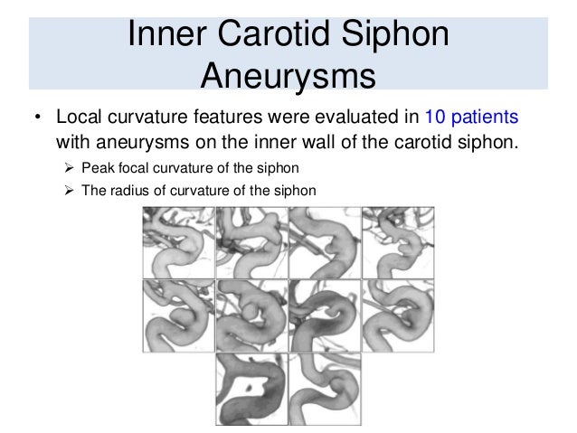 b-control Intracranial Aneurysms Curvature Carotid Brain and