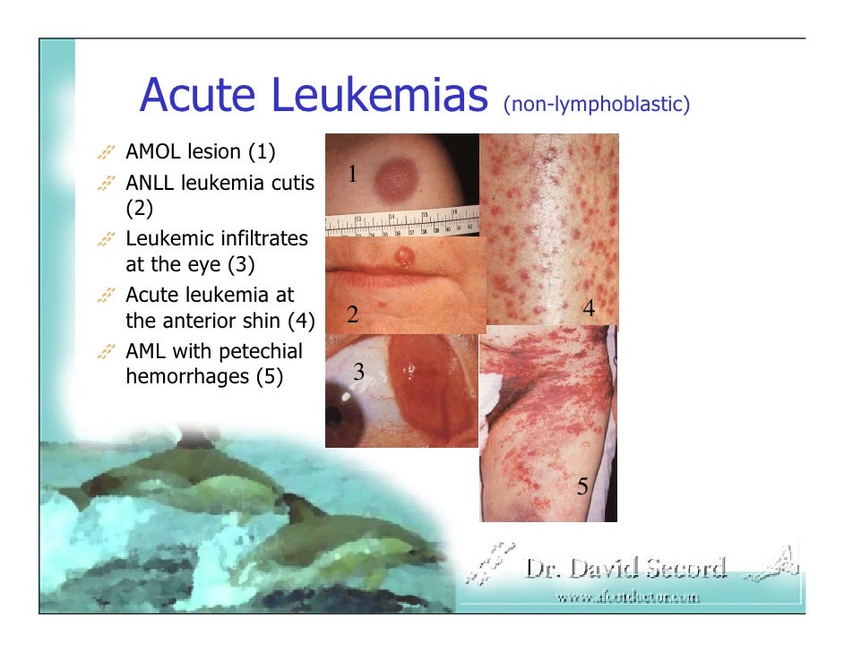 Cutaneous Presentations Of Systemic Diseases