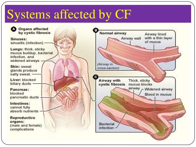 Skin signs of systemic disease in adults