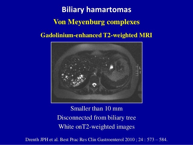 Cystic liver lesions - An ultrasound perspective