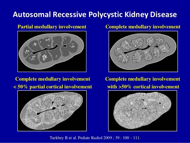 Fresenius dialysis careers zovirax kidney disease