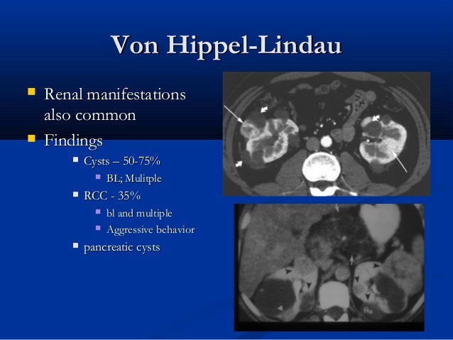 Renal Dialysis kinds