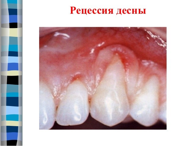 Резкие боли на 16 неделе беременности