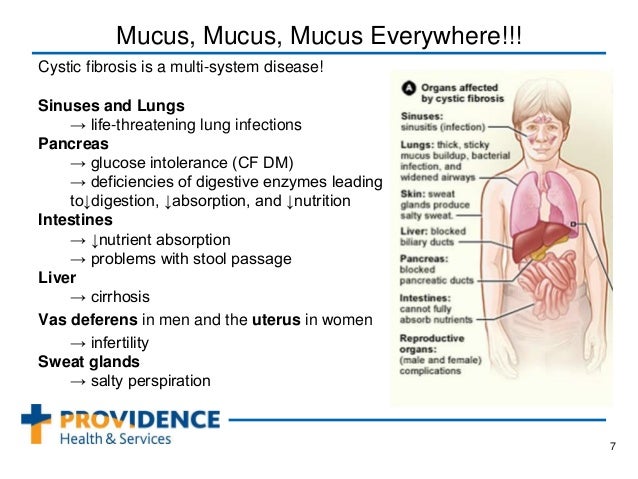 sinus comfort amazon