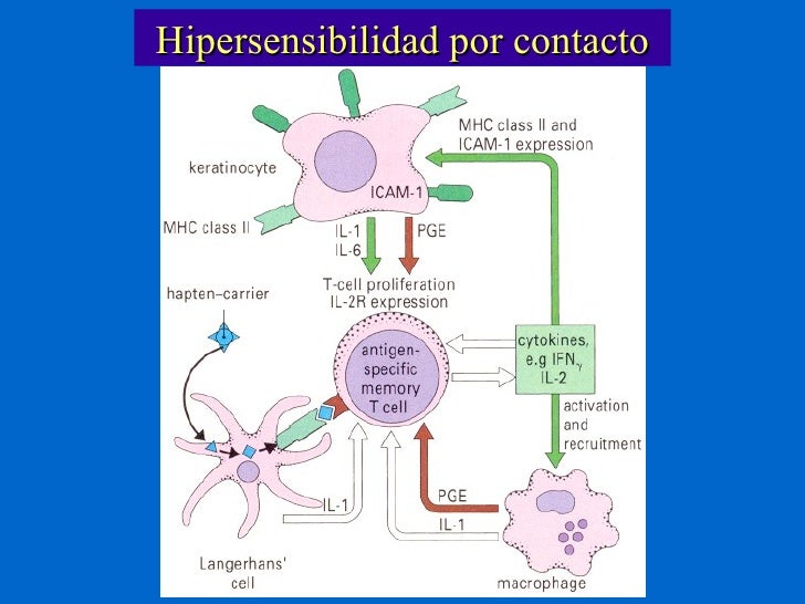DañO Por Hipersensibilidad