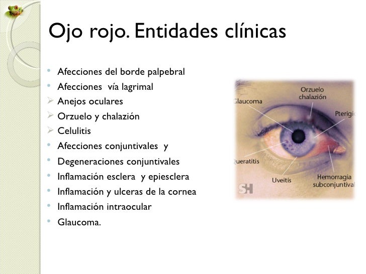 Los medios de las arrugas mímicas alrededor de los ojos las revocaciones