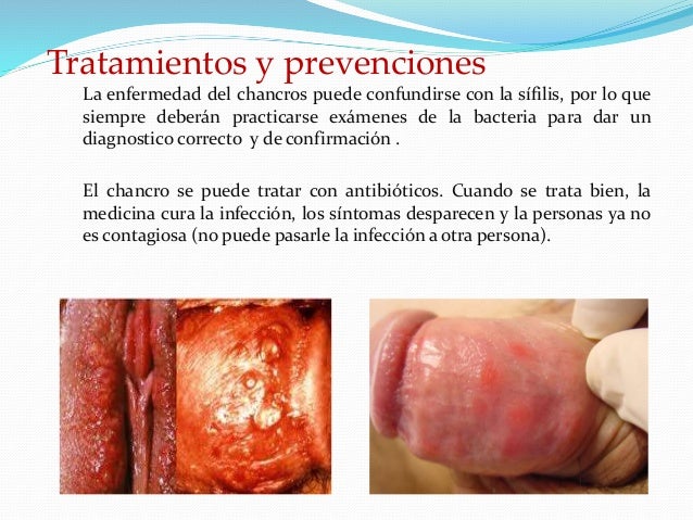 Los medios públicos para el tratamiento abstinentnogo del síndrome