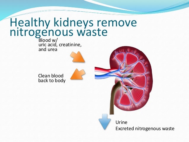 Kidney sickness Requiring Dialysis