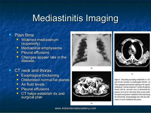 mesothelioma legal professional chicago