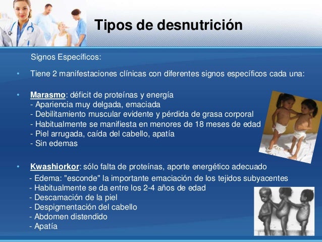 La alopecia en la nuca a las mujeres de la causa
