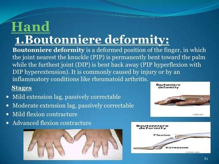 Deformities of human body pps