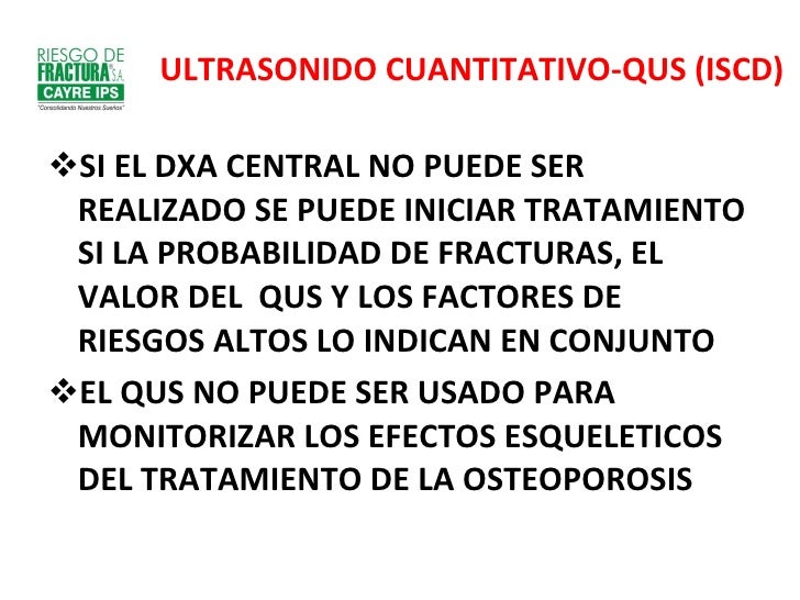 El esqueleto de los huesos sheynogo del departamento de la columna vertebral