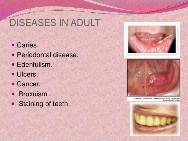 dental-hygiene-and-oral-care-19-638.jpg?cb=1356263868
